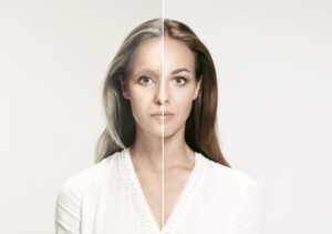 stem cell preservation treatment - FCP Dermatology - FCP Dermatology stem cell preservation treatment