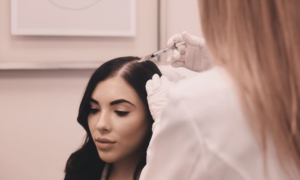prp for hair loss - FCP Dermatology - FCP Dermatology prp for hair loss