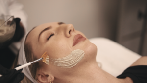 green peel - FCP Dermatology - FCP Dermatology green peel
