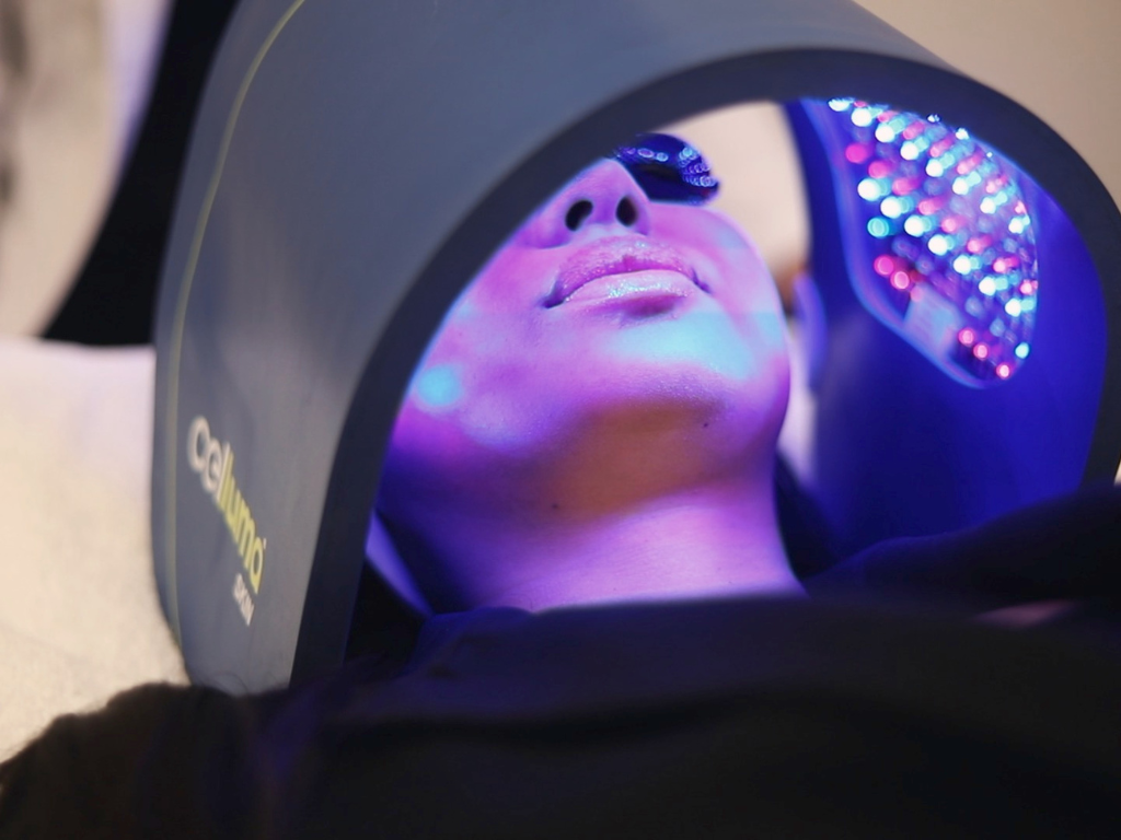 womens laser treatments
