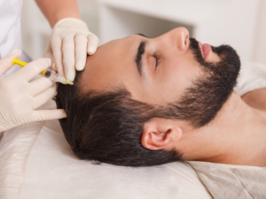hair restoration for men - FCP Dermatology - FCP Dermatology hair restoration for men