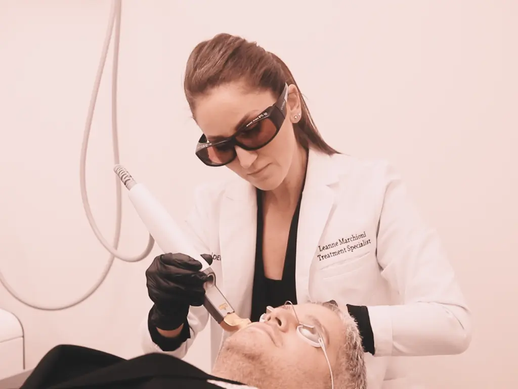 Laser Treatment for Rosacea​