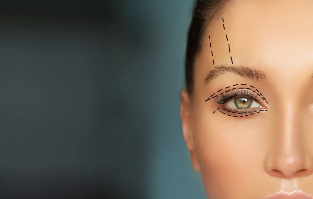 best blepharoplasty surgeon toronto