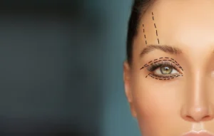 best blepharoplasty surgeon toronto - FCP Dermatology - FCP Dermatology best blepharoplasty surgeon toronto