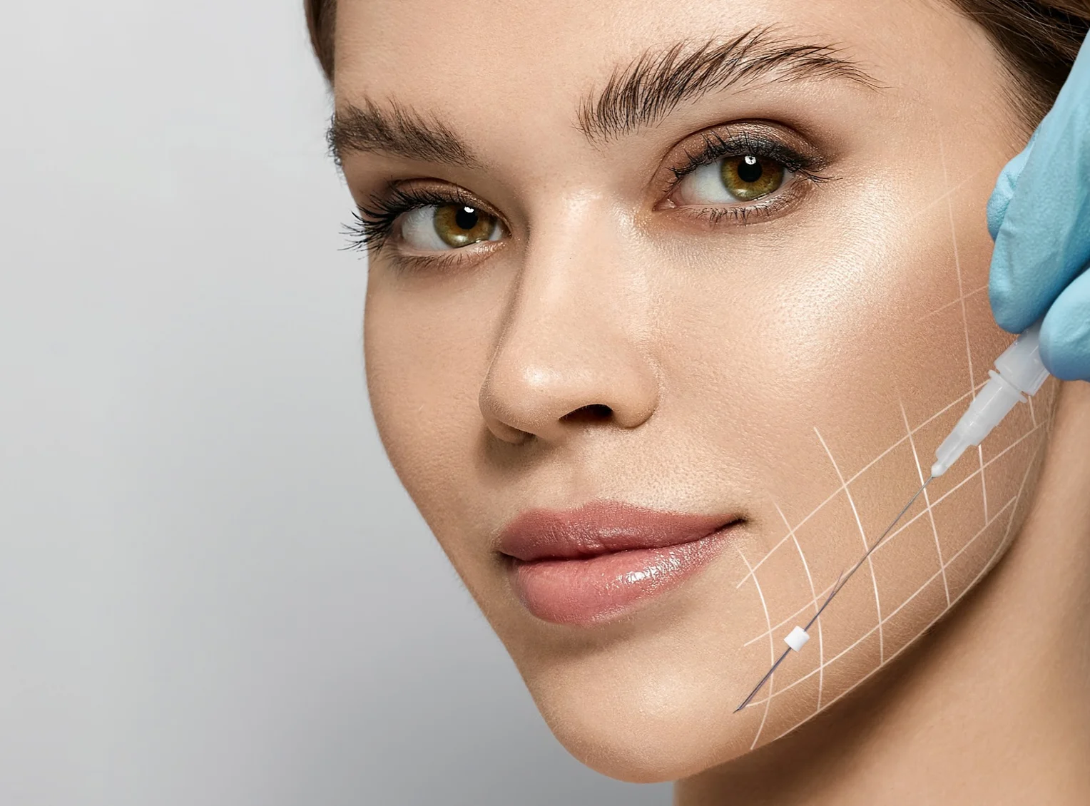 facelift