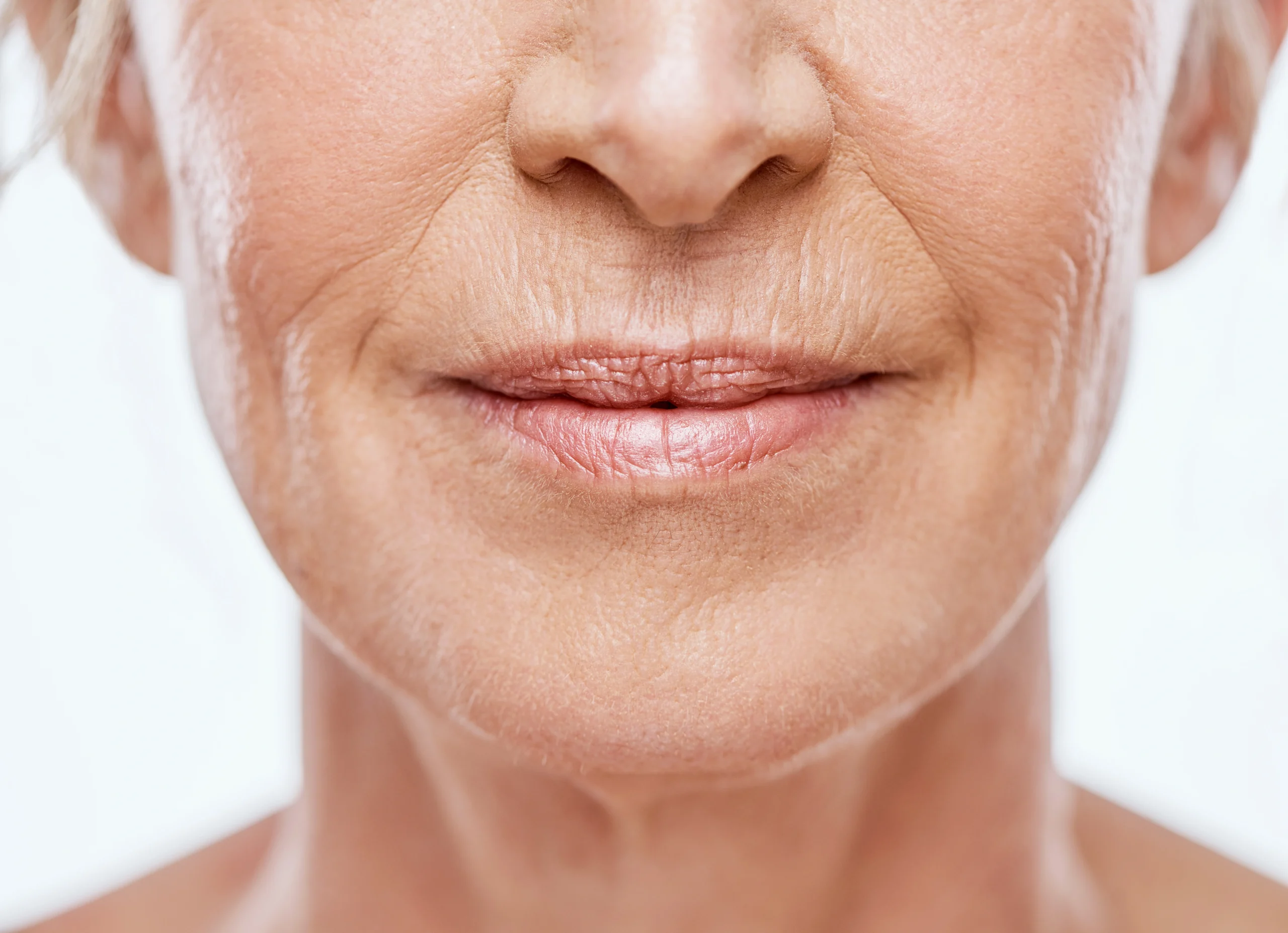 Fine Lines and Wrinkles treatment