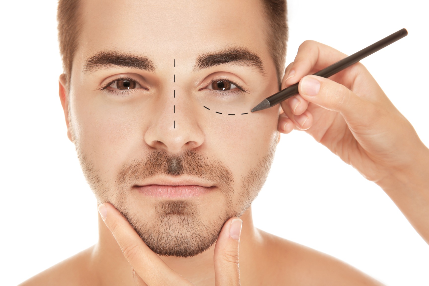 Under Eye Hollows & Hyaluronic Acid Fillers