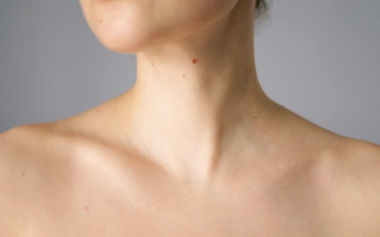 Lipoma removal treatment