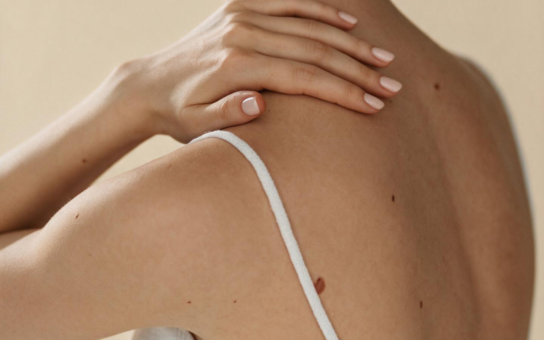 Mole removal treatment